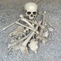 28 Piece broken bone skull